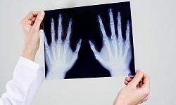 Рентгенография кисти( 2 проекции)