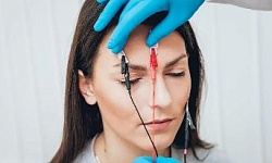 Электромиография лицевого нерва